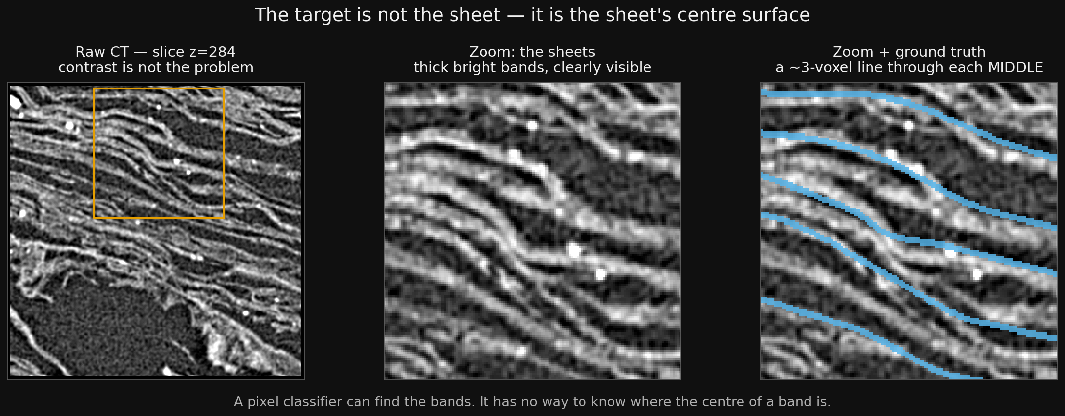 Left: the sheets in the raw CT. Right: the ground truth, a thin line through the middle of each band