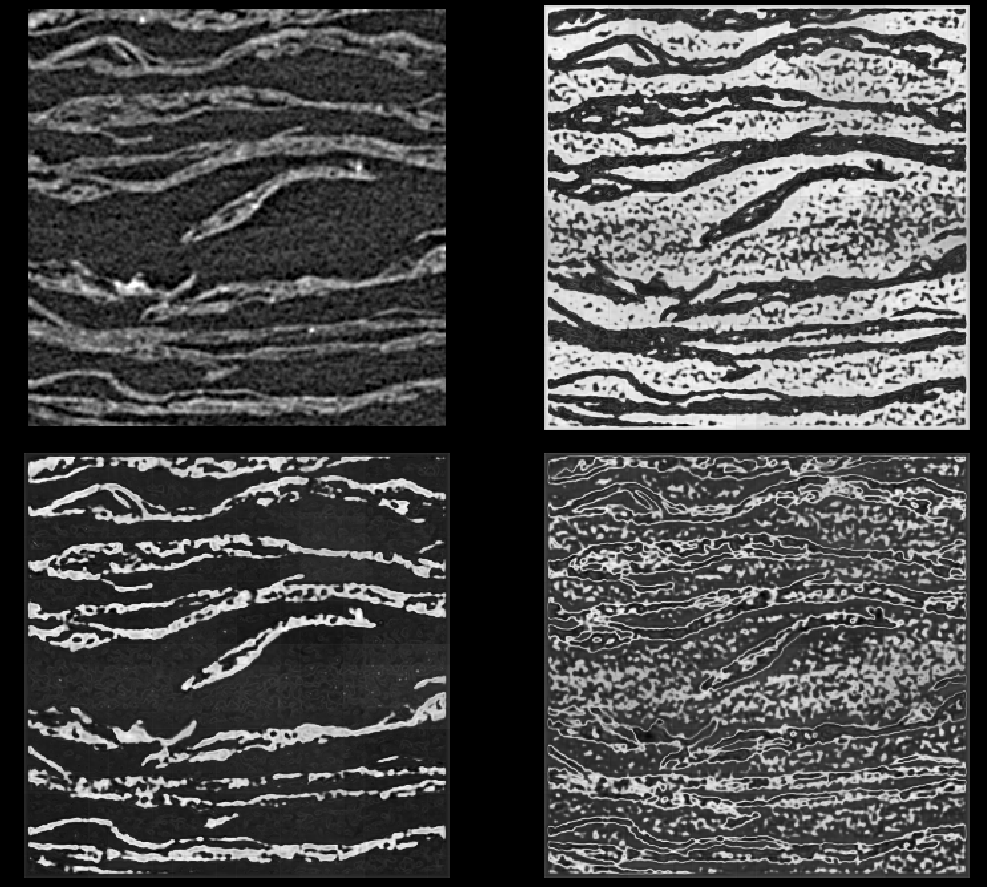 Raw CT slice and the three self-supervised WNet3D output channels