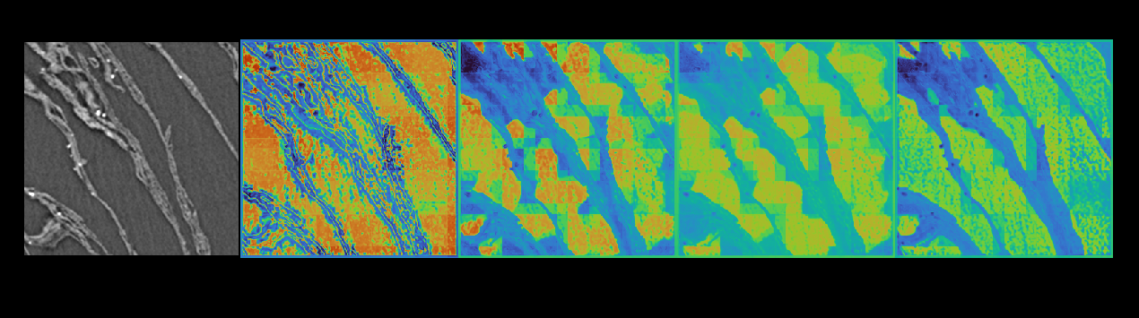 The same CT slice with feature channels from several different WNet3D configurations